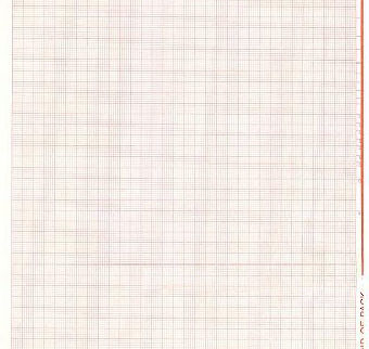 Nihon Kohden Z-Fold Red Grid Chart Paper #9100Z - fhmedicalservices